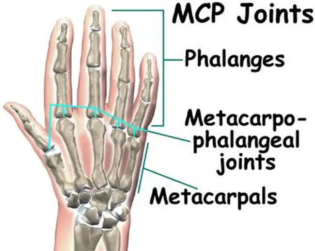 MetaCarpophalangeal Joint : 掌指关节