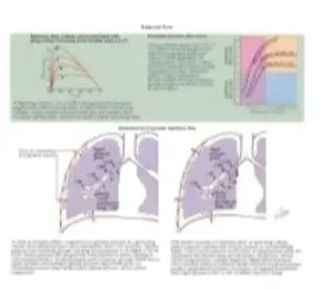 Maximal Mid-expiratory Flow : 最大呼气中期流量