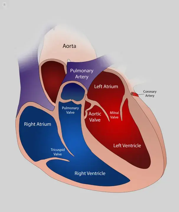 Mitral Regurgitation : 二尖瓣反流