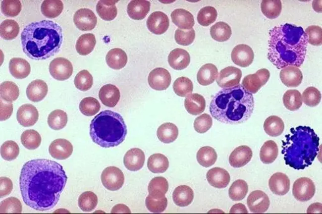 Leukocyte Antibody Detection : 白细胞抗体检测