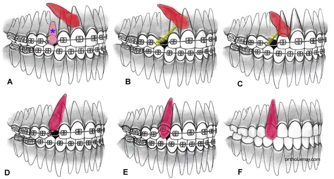 Canine Rhinotracheitis Infection : 犬鼻气管炎感染