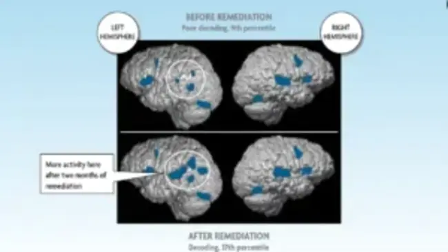 Brain State : 脑状态