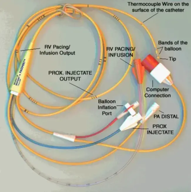 Pulmonary Arterial Pressure : 肺动脉压