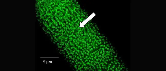 Mean Cell Hemoglobin : 平均细胞血红蛋白