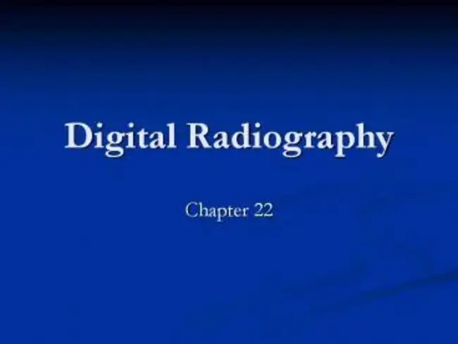 Computerized Digital Radiography : 计算机数字射线照相术