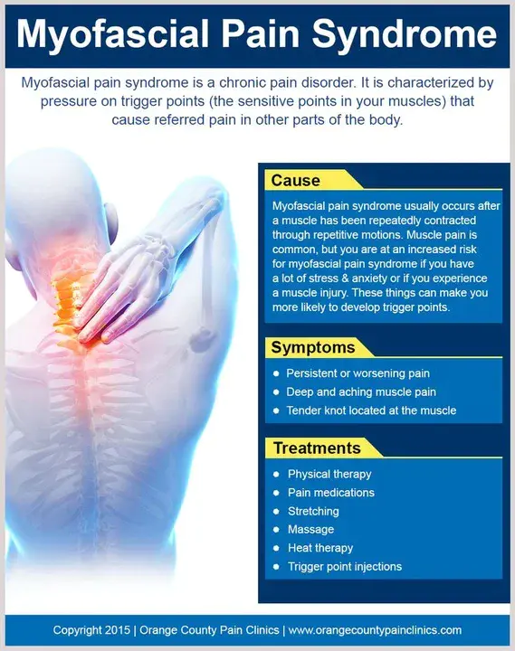 Myofacial Pain Syndrome : 肌面疼痛综合征