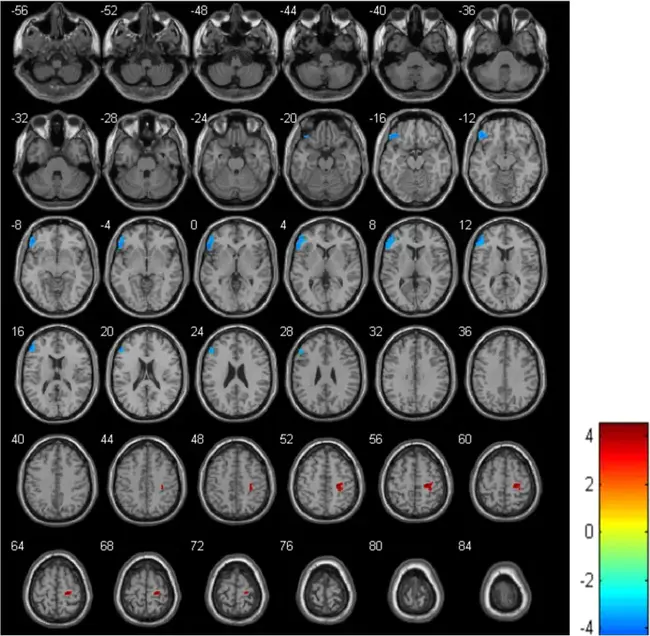 Cerebral Blood Flow : 脑血流