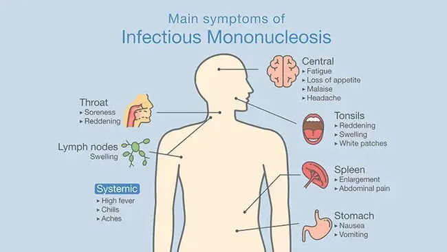 Mono Sodium Glutamate : 谷氨酸钠