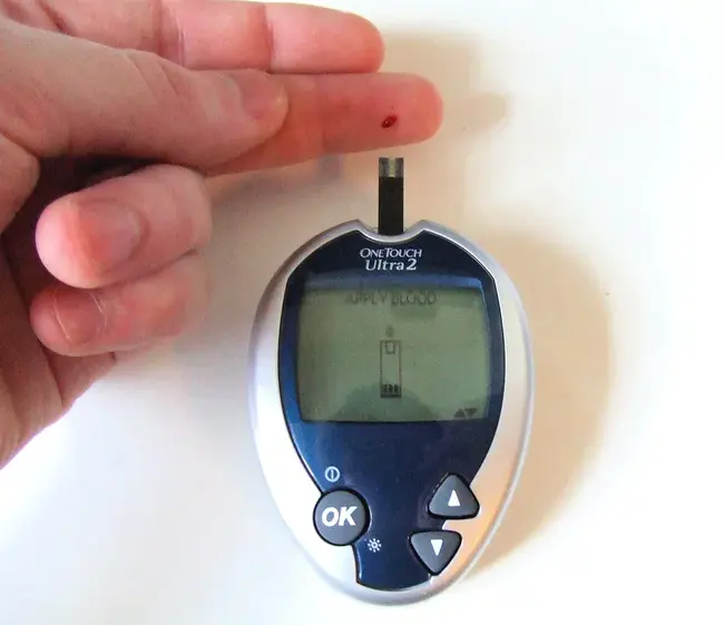 Diabetic Care Overview : 糖尿病护理概述