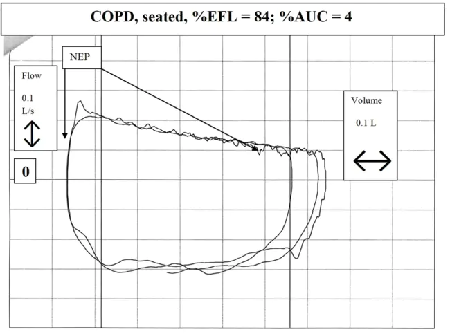 Expiratory Reserve Volume : 呼气储备量