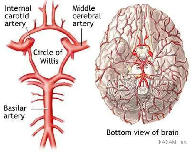 Basilar Artery VasoSpasm : 基底动脉痉挛