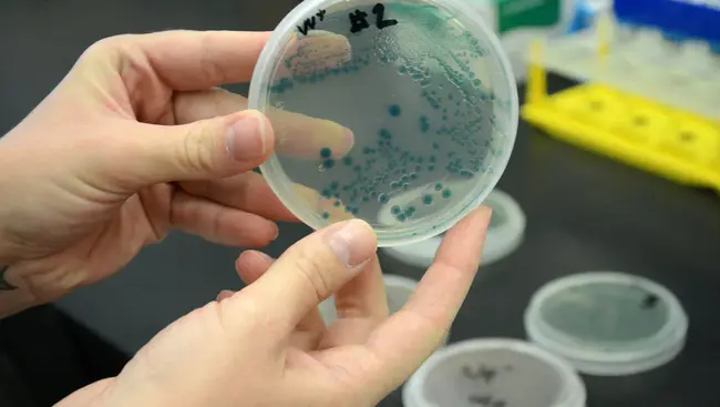 Flesh Eating Bacteria : 食肉细菌