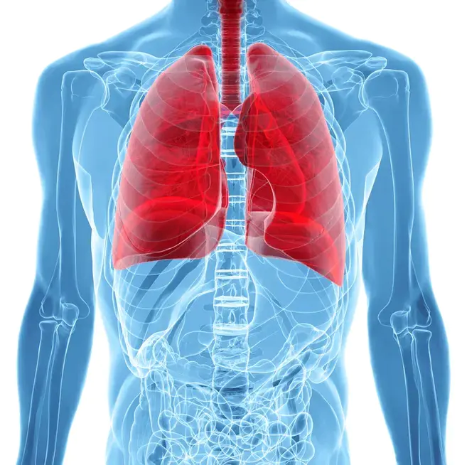 Pulmonary Embolism : 肺栓塞