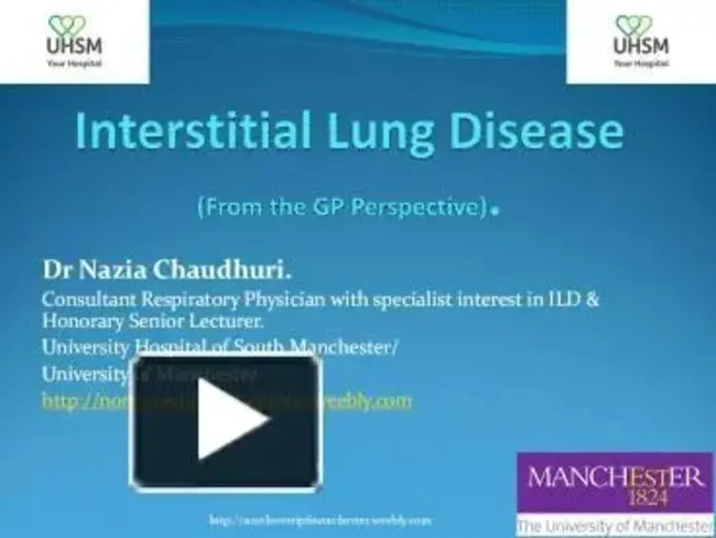 Interstitial Lung Disease : 间质性肺病