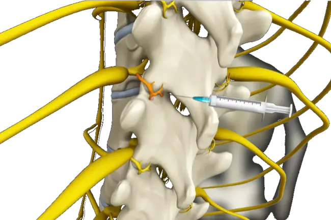 Medial Forebrain Bundle : 前脑内侧束