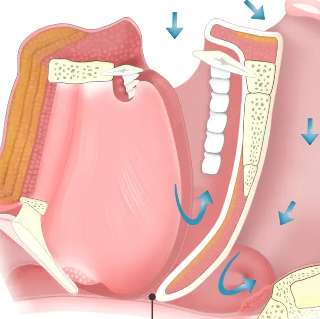 Obstructive Sleep Apnea : 阻塞性睡眠呼吸暂停