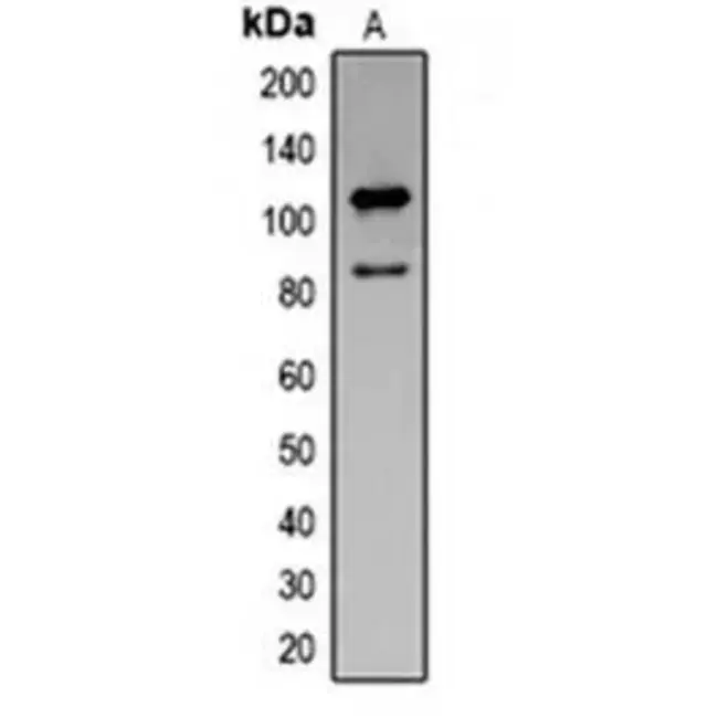 Cleaved Amplified Polymorphic Sequence : 酶切扩增多态性序列