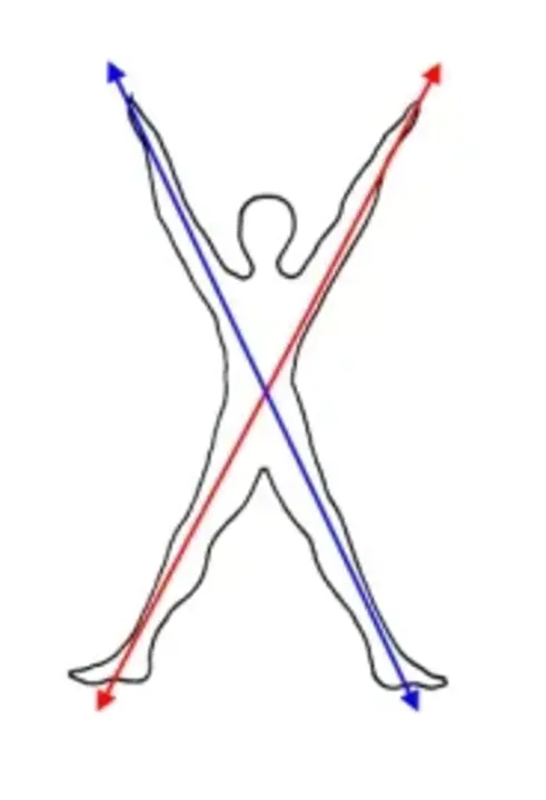 Contralateral Routing Of Signals : 信号的对侧路由