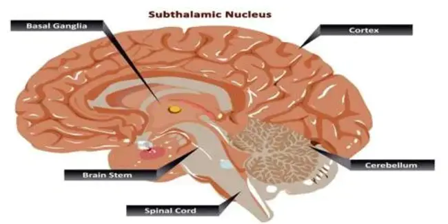 SubThalamic Nucleus : 下丘脑核