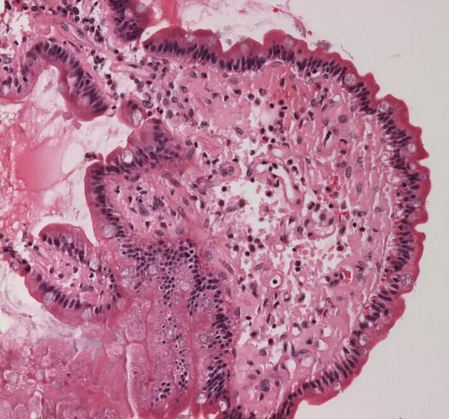 Amyloid Precursor Protein : 淀粉样前体蛋白