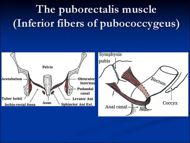 Pubococcygeal Muscle : 耻骨尾骨肌