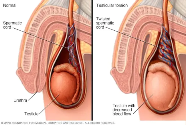 Testicular Self Examination : 睾丸自我检查