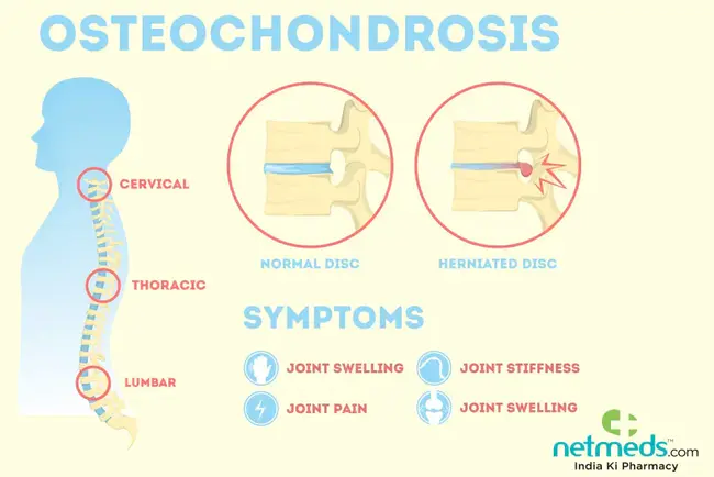 Osteochondrosis Foundation for Animals : 动物骨软骨病基金会