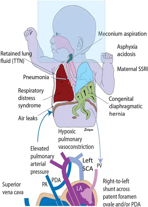 Neuro Immune Dysfunction Syndrome : 神经免疫功能障碍综合征