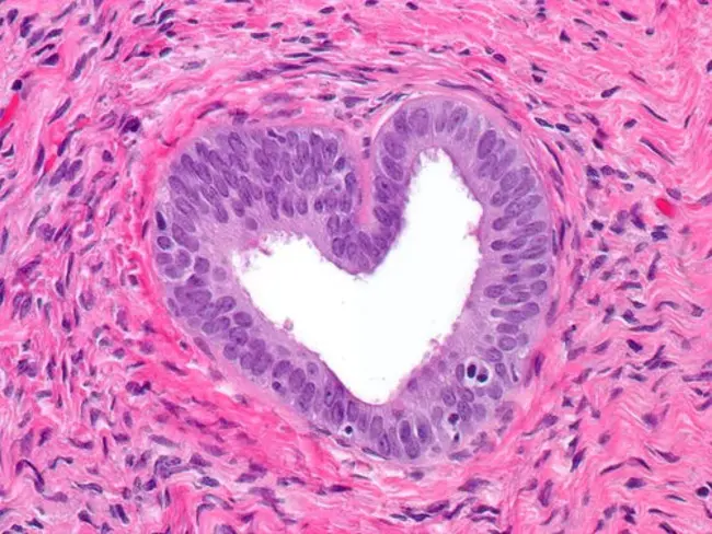 Pathology Bearing Regions : 病理承载区