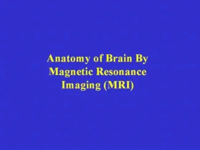 Advanced Magnetic Resonance Imaging And Spectroscopy : 高级磁共振成像和光谱学