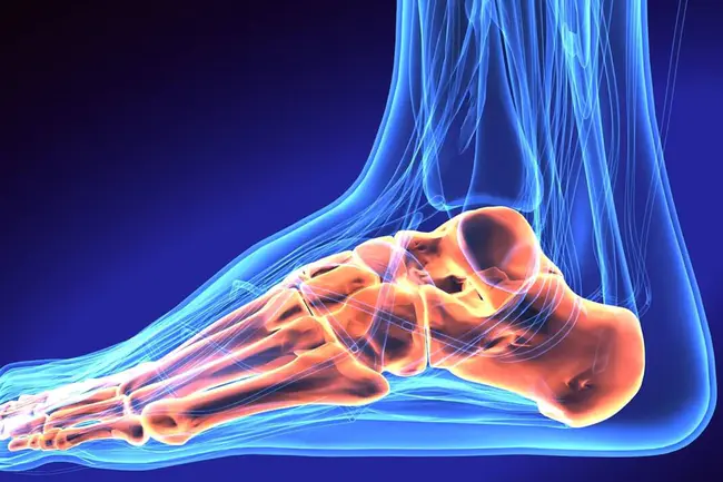 Tarsal Tunnel Syndrome : 跗管综合症