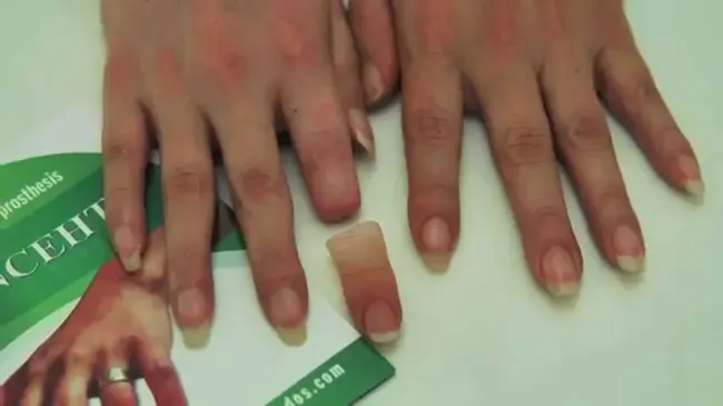 Finger Length Ratio : 指长比