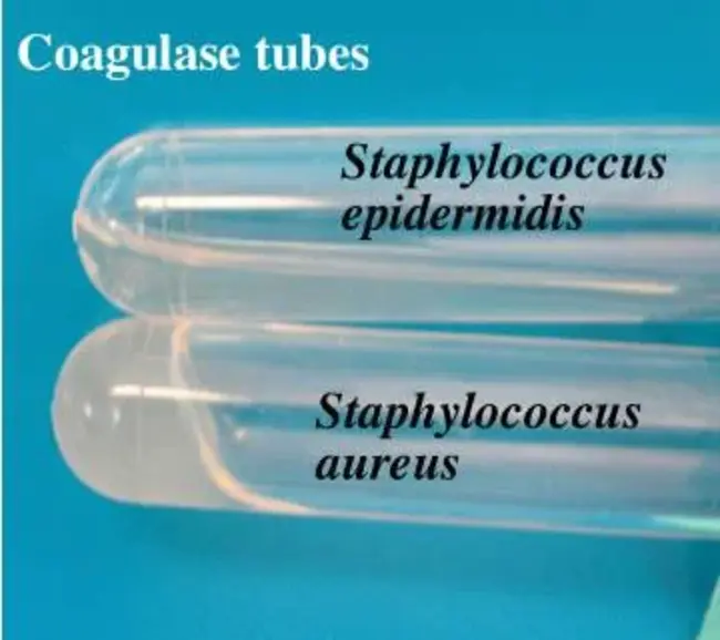 Coagulase Negative Staphylococcus : 凝固酶阴性葡萄球菌