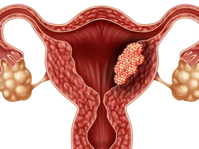 Endometrial Function Test : 子宫内膜功能试验