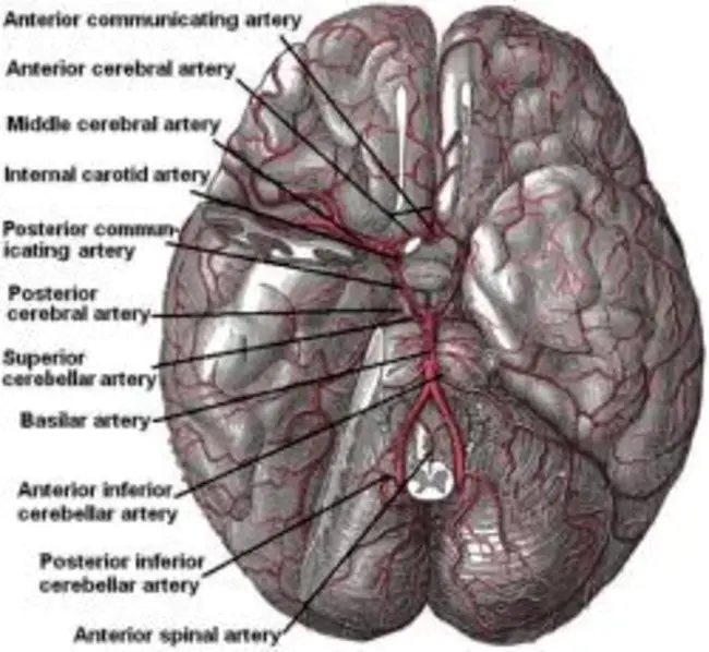 Basilar Artery Migraine : 基底动脉偏头痛