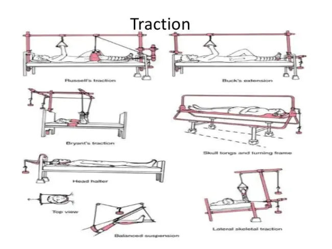 Traction Control System : 牵引力控制系统