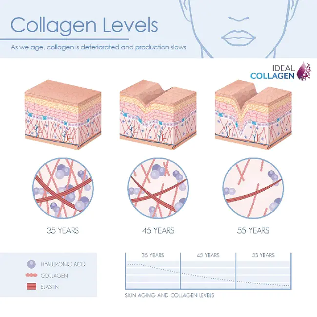 Collagen Induction Therapy : 胶原诱导治疗