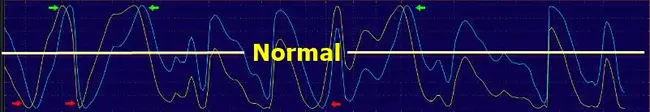 Normal Systems : 正规系统