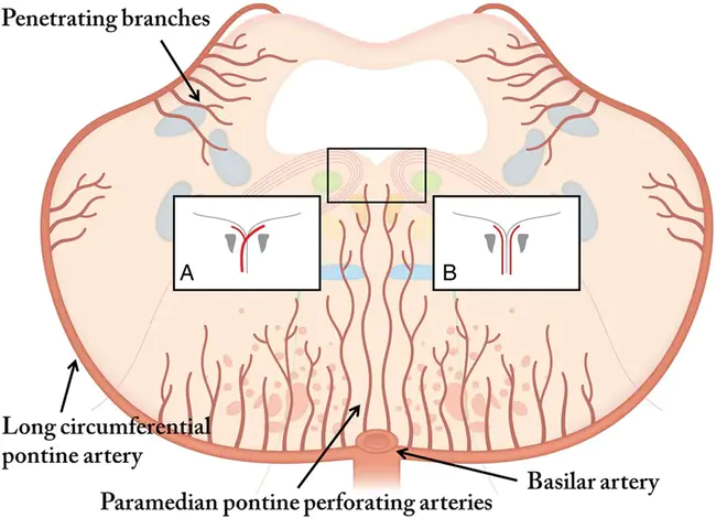 Pontine Geniculate Occipital : 枕骨桥膝