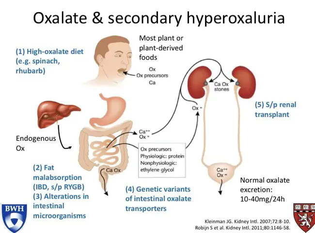 Oxalosis and Hyperoxaluria Foundation : 草酸中毒与高草酸尿症基金会