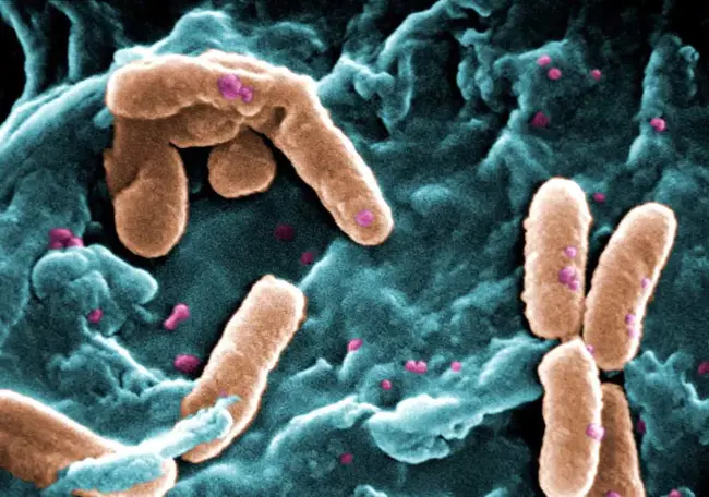 Pseudomonas Exotoxin : 假单胞菌外毒素