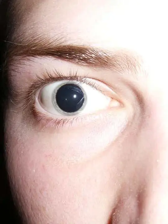 Pupil Rotation Compensation : 瞳孔旋转补偿