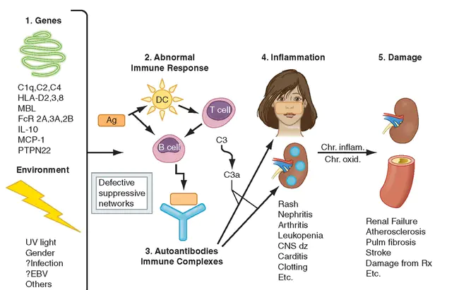 Syndrome Immunodéficitaire Acquis : 获得性免疫缺陷综合症