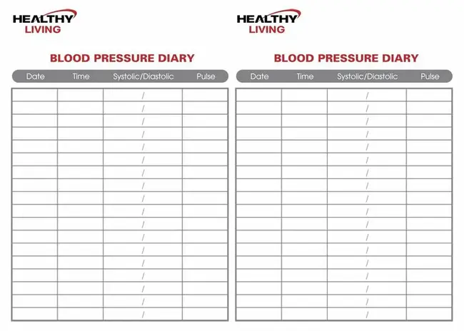 Pressure Zone Monitor : 压力区监测器