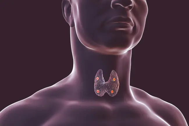 Parathyroid Hypertensive Factor : 甲状旁腺高血压因子