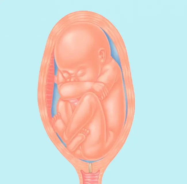 Abnormal Squamous Cells Of Unclear Significance : 意义不明的异常鳞状细胞