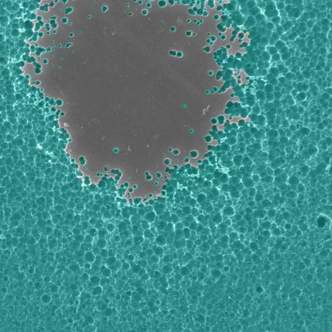 Enzyme Linked Immuno Sorbant Assay : 酶联免疫吸附试验