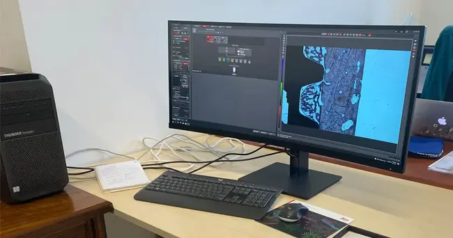 Quantitative X-ray Imager : 定量X射线成像仪