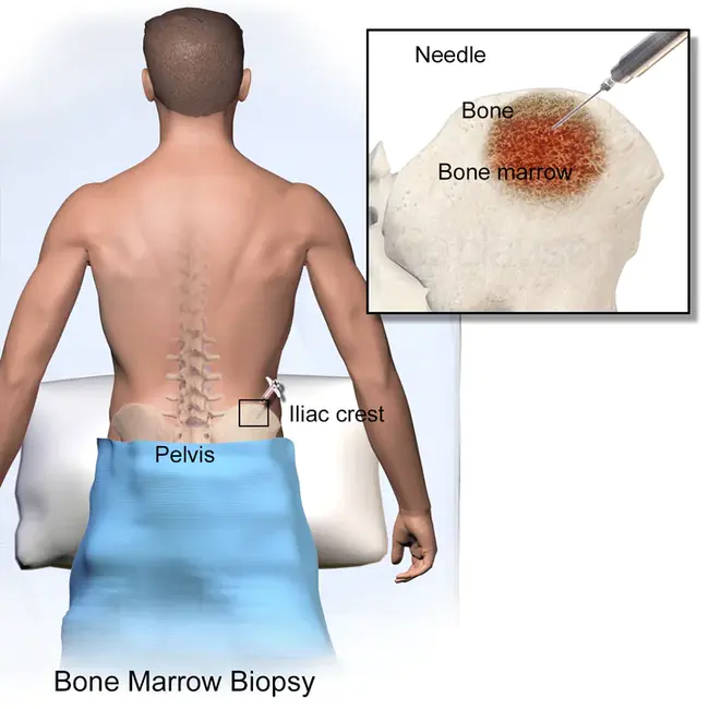 Bone Morphogenetic Proteins : 骨形态发生蛋白