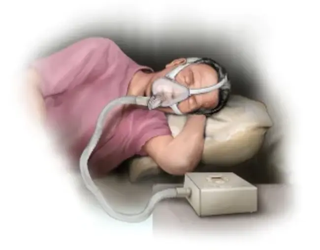 Positive Airway Pressure : 气道正压